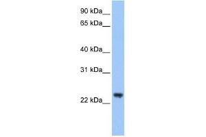 Western Blot showing TRIM48 antibody used at a concentration of 1-2 ug/ml to detect its target protein. (TRIM48 anticorps  (C-Term))
