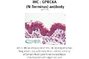 Image no. 2 for anti-G Protein-Coupled Receptor, Family C, Group 6, Member A (GPRC6A) (Extracellular Domain), (N-Term) antibody (ABIN1735226) (GPRC6A anticorps  (Extracellular Domain, N-Term))