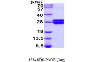SDS-PAGE (SDS) image for Glyoxalase I (GLO1) (AA 1-184) (Active) protein (His tag) (ABIN6387797) (GLO1 Protein (AA 1-184) (His tag))