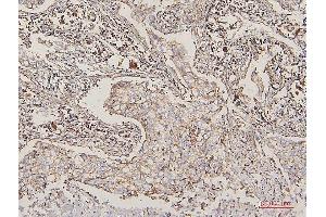 IHC analysis of LPP using anti-LPP antibody (ABIN7599606).