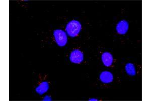 Proximity Ligation Analysis of protein-protein interactions between CDK2 and PCNA.