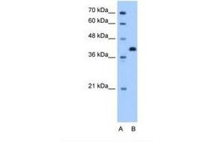 Image no. 1 for anti-Torsin Family 2, Member A (TOR2A) (AA 51-100) antibody (ABIN341411) (TOR2A anticorps  (AA 51-100))
