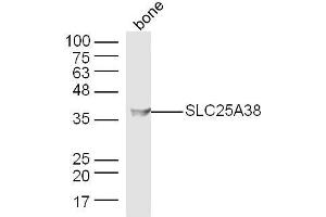 Mouse bone lysates probed with SLC25A38 Polyclonal Antibody, Unconjugated  at 1:300 dilution and 4˚C overnight incubation. (SLC25A38 anticorps  (AA 101-200))