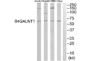 Western blot analysis of extracts from HeLa cells, K562 cells, HepG2 cells and HuvEC cells, using B4GALNT1 antibody. (B4GALNT1 anticorps)