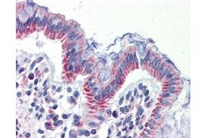 IMPDH1 antibody was used for immunohistochemistry at a concentration of 4-8 ug/ml. (IMPDH1 anticorps)