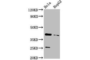 Western Blot Positive WB detected in: Hela whole cell lysate, HepG2 whole cell lysate All lanes: CD72 antibody at 3. (CD72 anticorps  (AA 150-208))