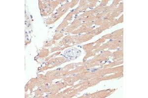 Immunohistochemistry of paraffin-embedded mouse kidney using WNT5B antibody (ABIN6130798, ABIN6150250, ABIN6150251 and ABIN6224330) at dilution of 1:100 (40x lens). (WNT5B anticorps  (AA 120-359))
