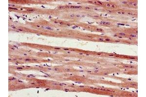 Immunohistochemistry of paraffin-embedded human heart tissue using ABIN7153133 at dilution of 1:100 (FHL2 anticorps  (AA 112-233))