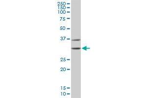 CDK4 monoclonal antibody (M03), clone 4F11.