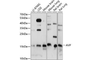 Western blot analysis of extracts of various cell lines, using AVP antibody (ABIN7265664) at 1:1000 dilution. (Vasopressin anticorps  (AA 20-164))