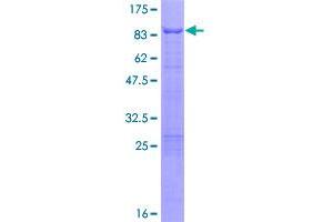 Image no. 1 for C-Jun-Amino-Terminal Kinase-Interacting Protein 2 (JIP-2) (AA 1-443) protein (GST tag) (ABIN1310309)