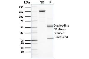 SDS-PAGE Analysis Purified PD-L1 Mouse Monoclonal Antibody (PDL1/2743). (PD-L1 anticorps  (AA 39-191))
