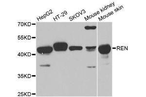 Western blot analysis of extracts of various cell lines, using REN antibody.