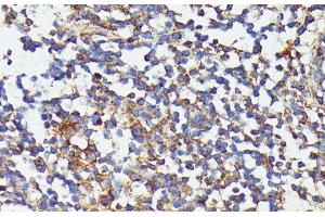 Immunohistochemistry of paraffin-embedded Human colon using CSF3 Polyclonal Antibody at dilution of 1:100 (40x lens). (G-CSF anticorps)