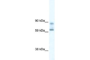 WB Suggested Anti-DDX42 Antibody Titration:  0.