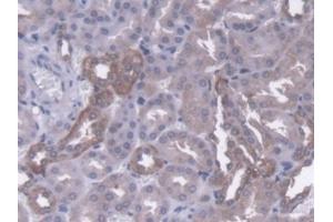 anti-Autocrine Motility Factor Receptor (AMFR) (AA 456-639) antibody