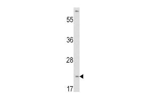 Western blot analysis of VHL antibody (N-term) (ABIN390462 and ABIN2840832) in HepG2 cell line lysates (35 μg/lane).