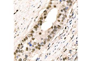 IHC analysis of CRTC3 using anti-CRTC3 antibody (ABIN7599779). (CRTC3 anticorps  (AA 116-619))