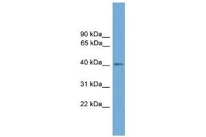 ZDHHC18 antibody used at 1 ug/ml to detect target protein. (ZDHHC18 anticorps  (Middle Region))