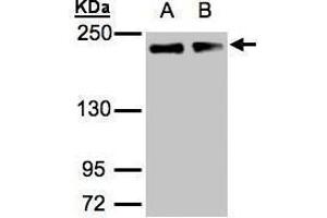 WB Image Sample(30 μg of whole cell lysate) A:A431, B:H1299 5% SDS PAGE antibody diluted at 1:1000 (Golgin A3 anticorps  (C-Term))