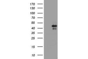 Image no. 1 for anti-TIA1 Cytotoxic Granule-Associated RNA Binding Protein (TIA1) antibody (ABIN1501388) (TIA1 anticorps)