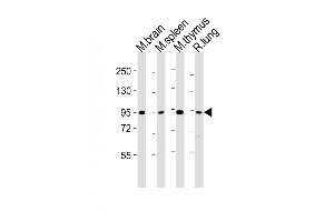 All lanes : Anti-Med15 Antibody (C-term) at 1:2000 dilution Lane 1: mouse brain lysates Lane 2: mouse spleen lysates Lane 3: mouse thymus lysates Lane 4: rat lung lysates Lysates/proteins at 20 μg per lane.