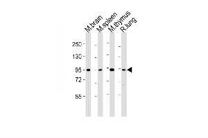 All lanes : Anti-Med15 Antibody (C-term) at 1:2000 dilution Lane 1: mouse brain lysates Lane 2: mouse spleen lysates Lane 3: mouse thymus lysates Lane 4: rat lung lysates Lysates/proteins at 20 μg per lane. (MED15 anticorps  (C-Term))