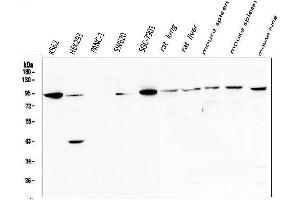 Western blot analysis of STAT5b using anti-STAT5b antibody (ABIN3042740).