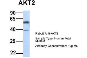 Host: Rabbit  Target Name: AKT2  Sample Tissue: Human Fetal Muscle  Antibody Dilution: 1. (AKT2 anticorps  (Middle Region))