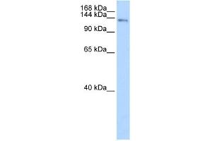 WB Suggested Anti-CIZ1 Antibody Titration:  0.