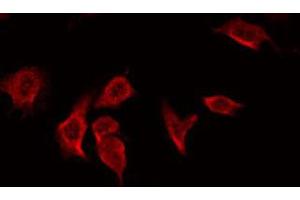 ABIN6266597 staining Hela by IF/ICC.