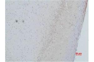 Immunohistochemical analysis of paraffin-embedded Rat Brain Tissue using CACNG2 Polyclonal Antibody.