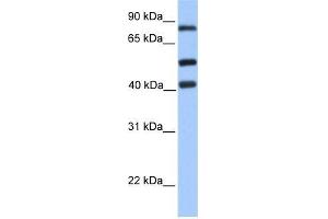 Human Jurkat; WB Suggested Anti-HCFC2 Antibody Titration: 0. (HCFC2 anticorps  (C-Term))