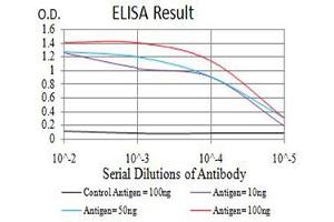 Black line: Control Antigen (100 ng),Purple line: Antigen (10 ng), Blue line: Antigen (50 ng), Red line:Antigen (100 ng) (eIF4EBP1 anticorps  (pSer65))