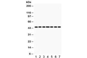 Western blot testing of 1) rat lung, 2) rat kidney, 3) rat brain, 4) human HeLa, 5) SMMC, 6) A549 and 7) mouse NIH3T3 lysate with IDH1 antibody. (IDH1 anticorps)