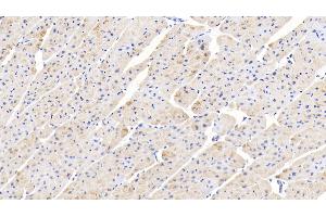 Detection of PPARg in Human Cardiac Muscle Tissue using Polyclonal Antibody to Peroxisome Proliferator Activated Receptor Gamma (PPARg)