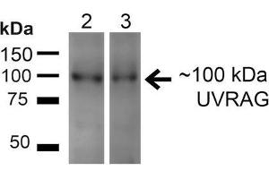 Western blot analysis of Human HeLa and 293T cell lysates showing detection of ~100kDa UVRAG protein using Rabbit Anti-UVRAG Polyclonal Antibody .