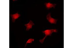 ABIN6267020 staining HuvEc by IF/ICC. (APC anticorps  (pSer2054))