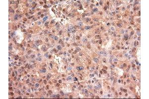 Image no. 11 for anti-Myc Proto-Oncogene protein (MYC) antibody (ABIN1497012) (c-MYC anticorps)