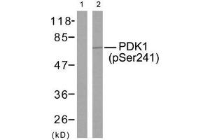 Western blot analysis of extracts from MDA-MB-435 cells using PDK1 (phospho-Ser241) antibody (E011005). (PDPK1 anticorps  (pSer241))