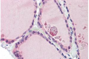 Human Thyroid (formalin-fixed, paraffin-embedded) stained with LDOC1 antibody ABIN462213 followed by biotinylated goat anti-rabbit IgG secondary antibody ABIN481713, alkaline phosphatase-streptavidin and chromogen. (LDOC1 anticorps  (N-Term))