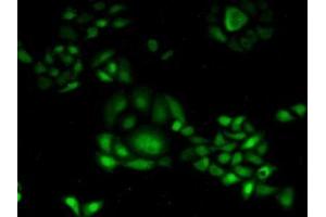 Detection of CDA in Human Hela Cells using Polyclonal Antibody to Cytidine Deaminase (CDA) (CDA anticorps  (AA 2-146))