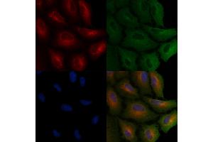 ABIN6265678 and ABIN6266689 staining  cells by IF/ICC. (TP53I11 anticorps  (N-Term))