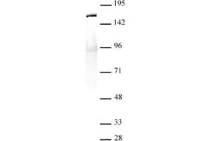 SMC1- α antibody (pAb) tested by Immunoprecipitation. (SMC1A anticorps  (C-Term))