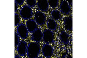 Immunofluorescence (IF) image for anti-Vimentin (VIM) (AA 325-375) antibody (ABIN7449539)