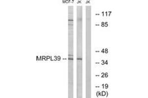 Western Blotting (WB) image for anti-Mitochondrial Ribosomal Protein L39 (MRPL39) (AA 289-338) antibody (ABIN2890417) (MRPL39 anticorps  (AA 289-338))
