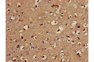 Immunohistochemistry of paraffin-embedded human brain tissue using ABIN7159316 at dilution of 1:100 (Melatonin Receptor 1B anticorps  (AA 1-42))