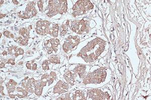 Immunohistochemistry of paraffin-embedded human stomach using MAP1LC3B antibody. (LC3B anticorps)