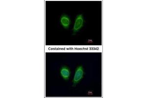 anti-DEAD (Asp-Glu-Ala-Asp) Box Polypeptide 1 (DDX1) (Internal Region) antibody