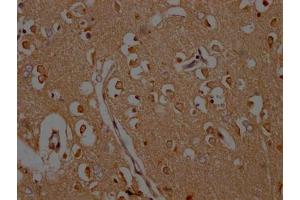 IHC image of ABIN7146439 diluted at 1:200 and staining in paraffin-embedded human brain tissue performed on a Leica BondTM system. (CAMK2A anticorps  (AA 321-478))